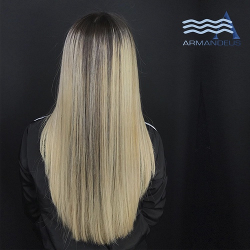 Before and after stem cells hair treatment at Salon Armandeus Doral